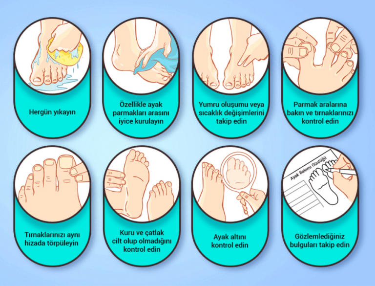 Diyabetik Ayak Bakımı Turan Turan