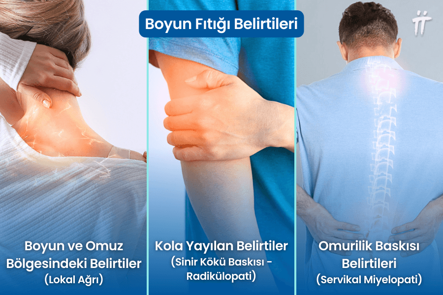 boyun fıtığı belirtileri