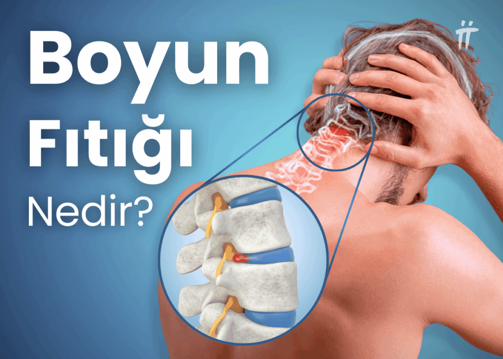 boyun fıtığı nedir