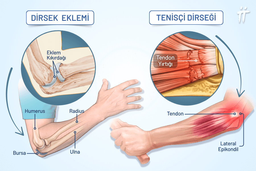  Dirsek Eklemi Anatomisi ve Tenisçi Dirseği