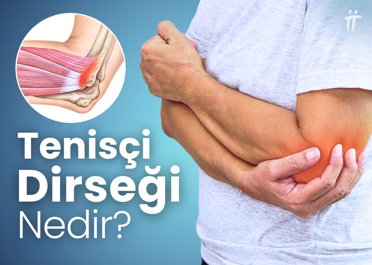 Tenisçi dirseği nedir