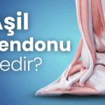 Aşil tendonu nedir