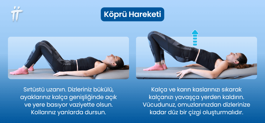 Köprü hareketi, beli destekleyen temel kas gruplarını çalıştırarak bel ağrısını hafifletebilir.
