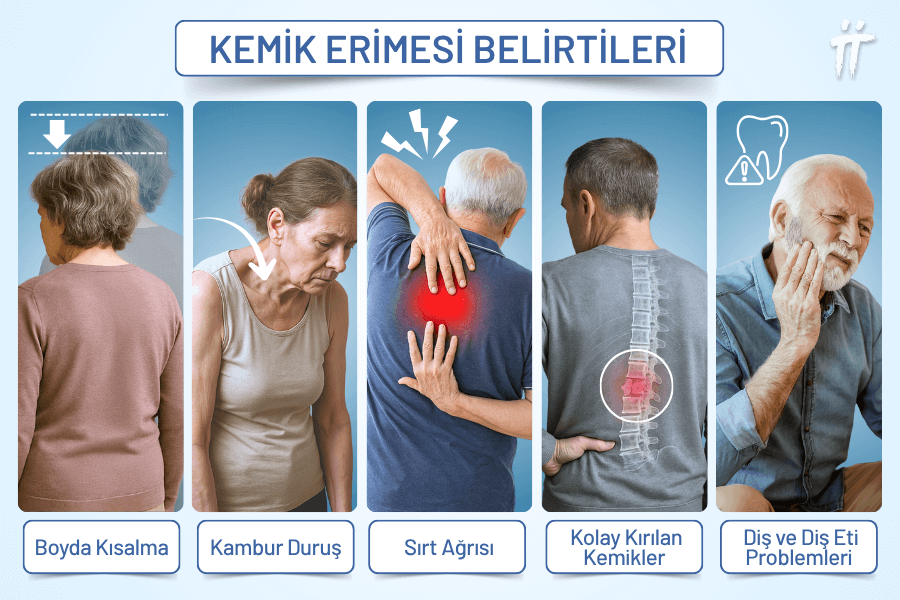 osteoporoz belirtileri