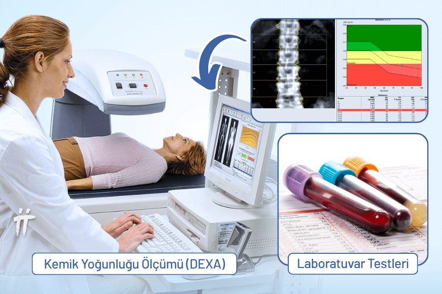  Osteoporoz tanısı için kullanılan DEXA tarama yöntemi, kemik mineral yoğunluğunu ölçer.
