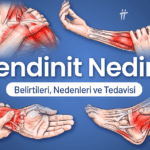 tendinit nedir