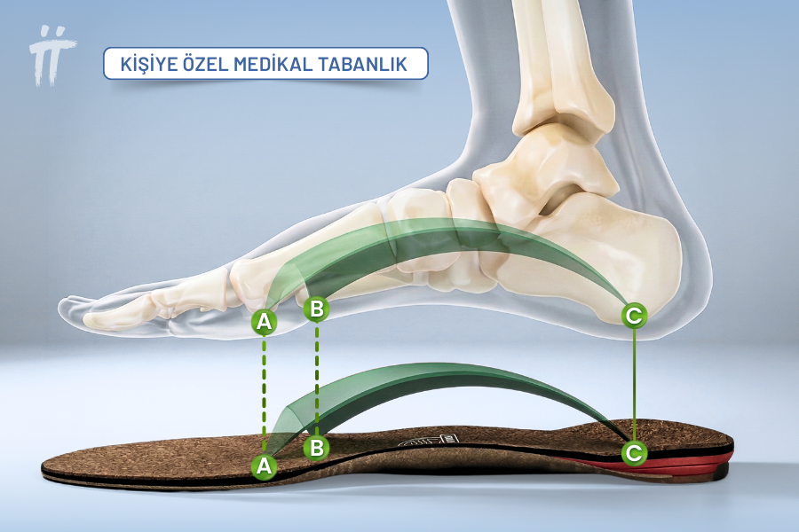Kişiye özel tabanlık, vücut yükünü dengeli dağıtarak hareket prensibine dayalı sorunları düzeltmeye yardımcı olur.
