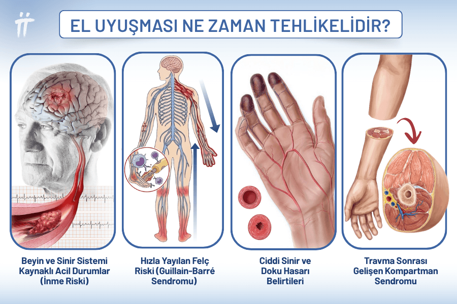 El uyuşmasında acil müdahale gerektiren 4 kritik durum: İnme, Guillain-Barré Sendromu, ilerleyici sinir hasarı ve Kompartman Sendromu.