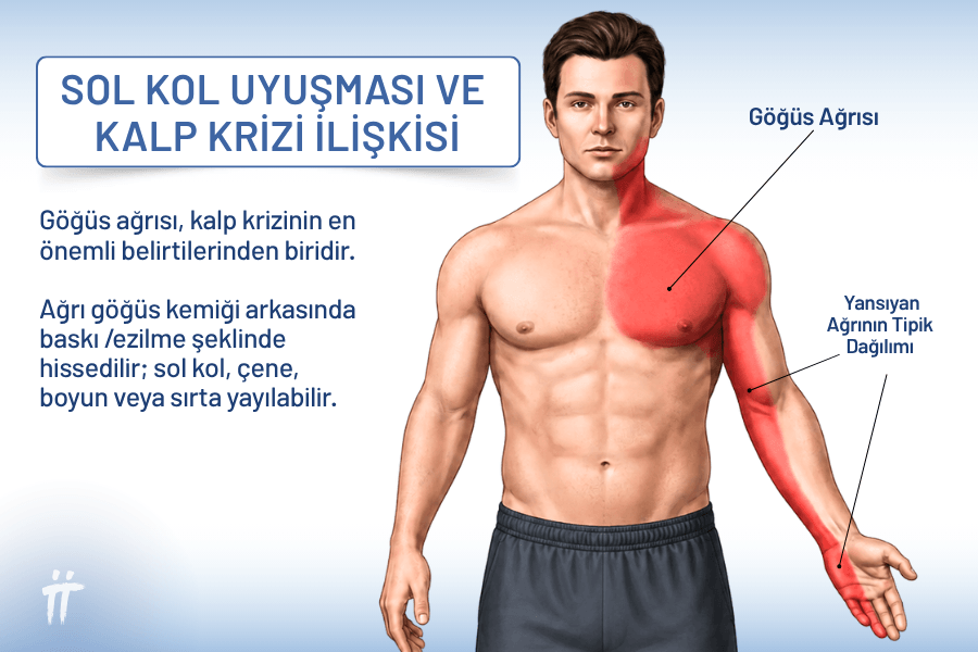 Kalp krizinde tipik yansıyan ağrı dağılımı—göğüs, sol kol, çene.