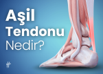 aşil tendonu nedir