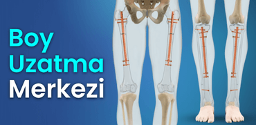 boy uzatma merkezi