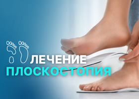 плоскостопие лечение турция