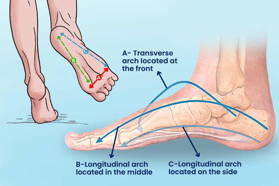 Naturally occurring arches on the sole of the foot. In flatfoot, the medial longitudinal arch between A-C is disrupted and lost and flattening occurs on the inner side of the sole.