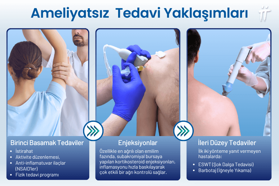 Kalsifik Tendinit Nasıl Tedavi edilir? 
