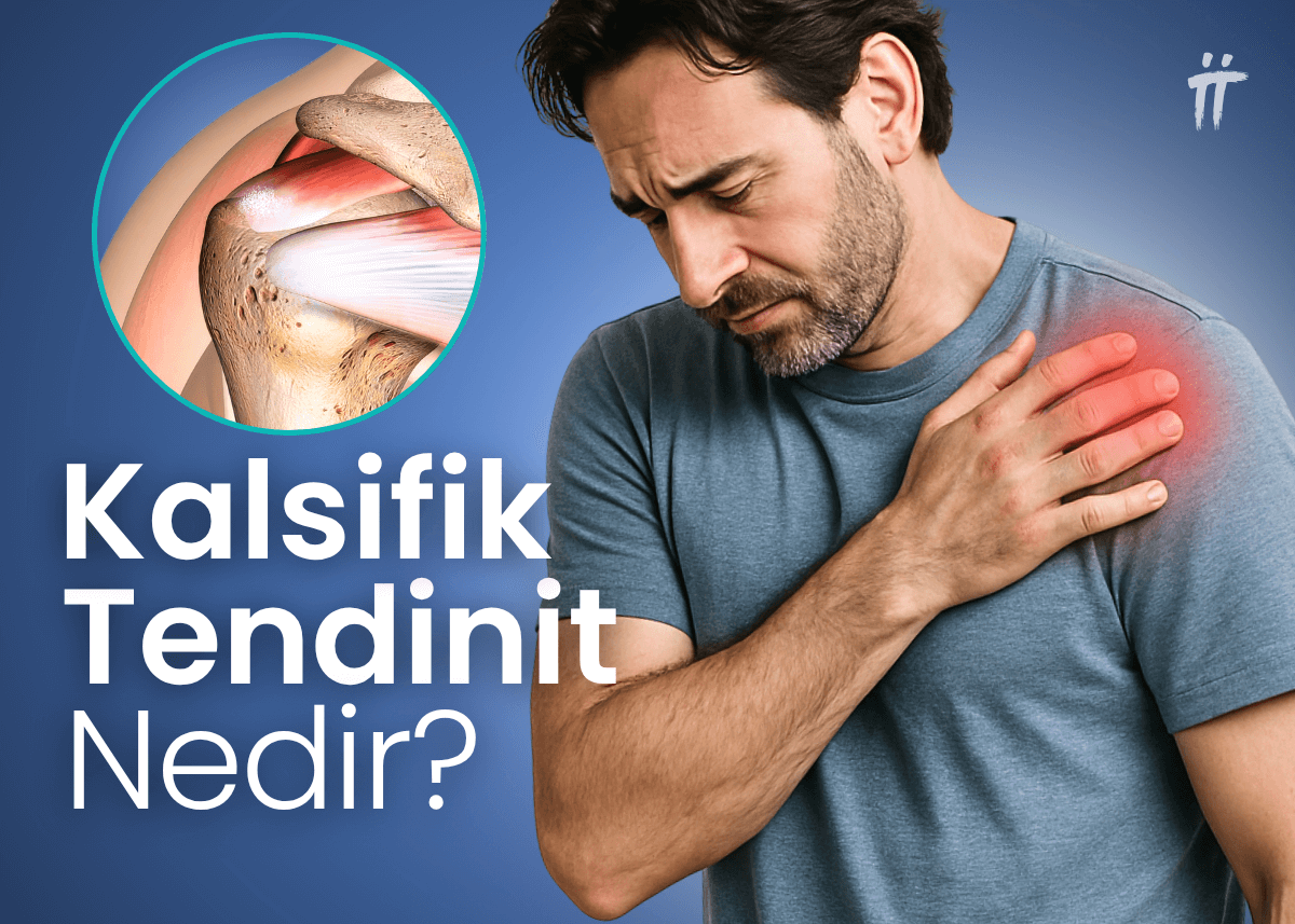 kalsifik tendinit nedir belirtleri nelerdir