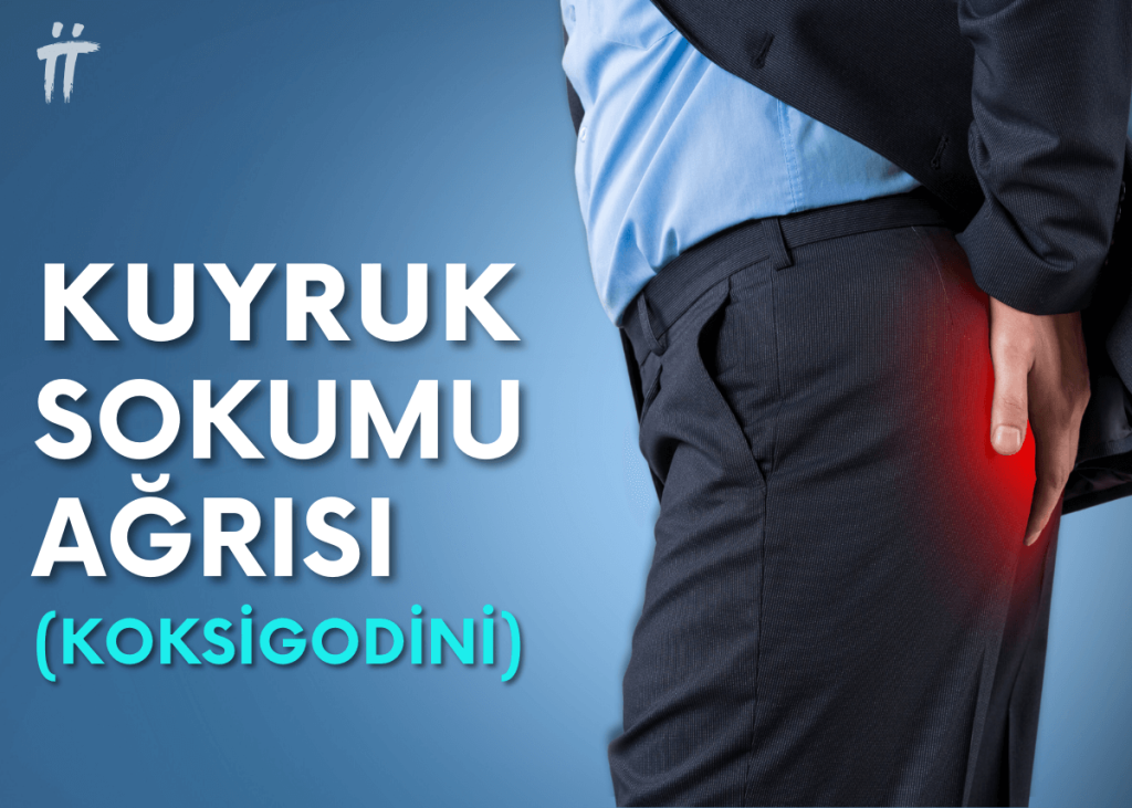 Kuyruk Sokumu Ağrısı (KOKSİGODİNİ)