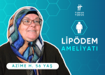 lipödem ameliyatı sonrası yorumlar