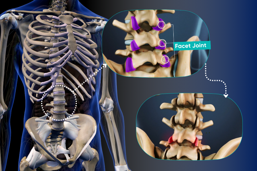 What is spinal stenosis? Symptoms and Treatment - Turan&Turan