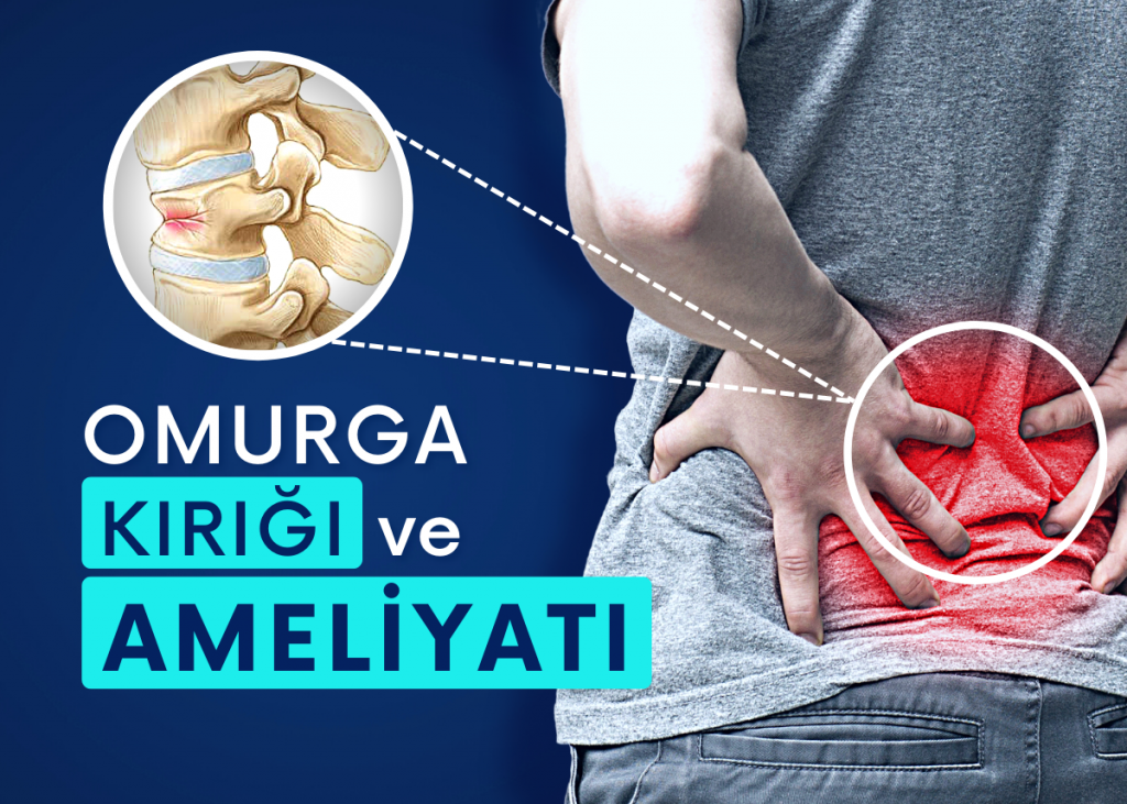 Omurga Kırıkları ve Omurga Kırığı Ameliyatı
