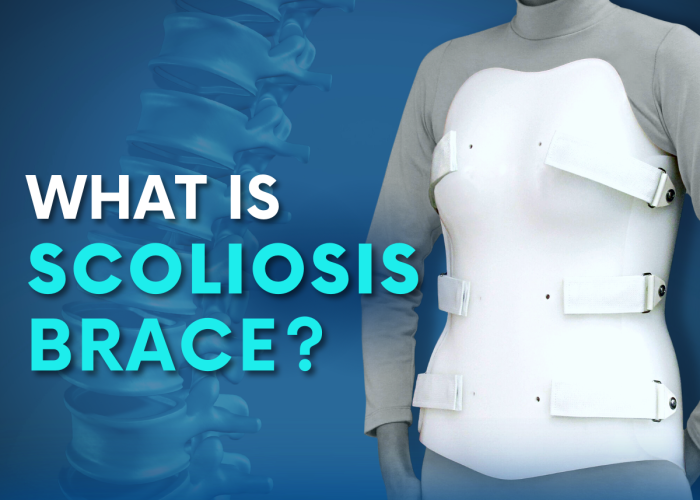 Scoliosis Braces Can Scoliosis be Corrected with a Brace? Turan&Turan