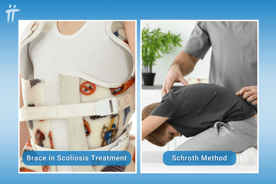 brace and Schroth method methods in scoliosis treatment