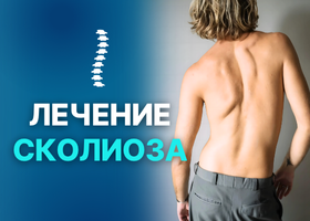 Лечение сколиоза