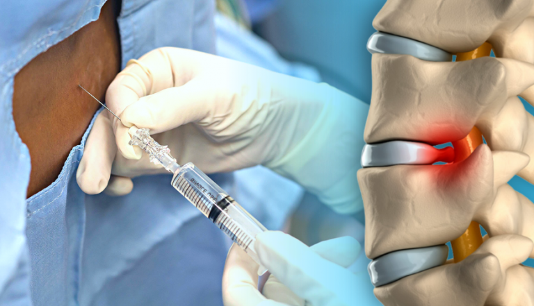 tekrarlayan-bel-a-r-lar-in-spinal-nesi-tedavisi-turan-turan