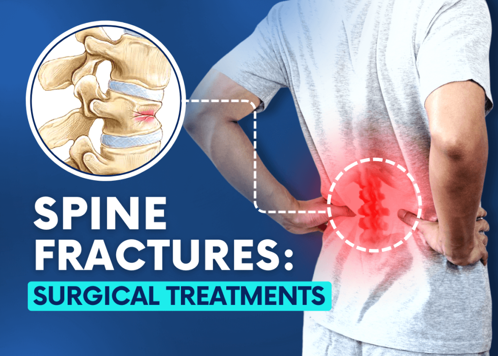 Spine Fractures and Spine Fracture Surgery