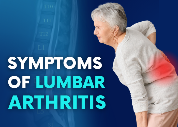 Lumbar Arthritis: Causes, Symptoms, and Treatment - Turan&Turan