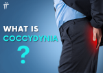 what is coccydynia coccyx pain