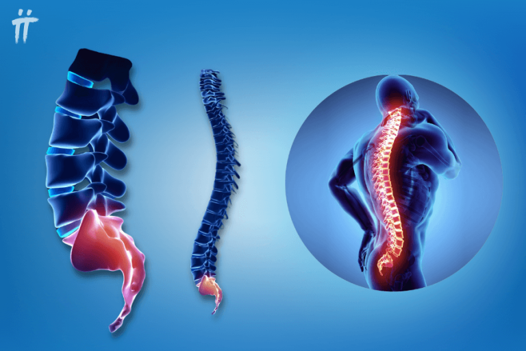 Tailbone Pain (Coccygodynia): Coccyx Pain Symptoms, Treatment - Turan&Turan