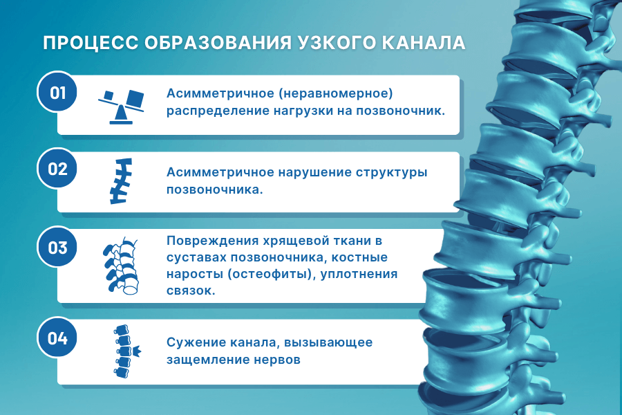 Процесс формирования узкого канала.
